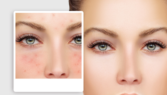 How Long Does It Take to See Results from LED Light Therapy?